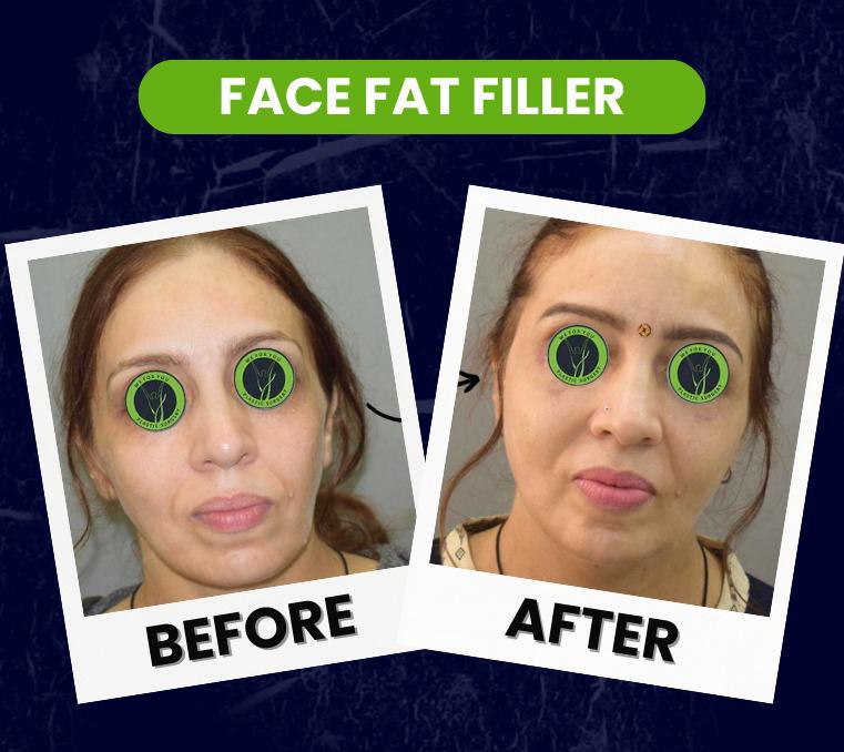 arm lift plastic surgery